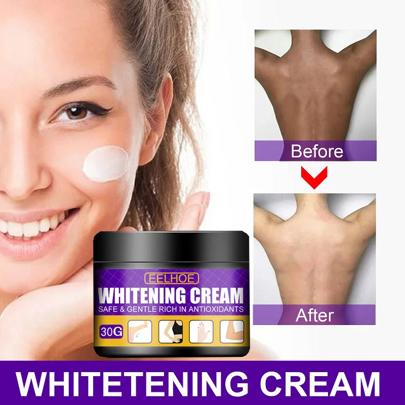 Whitening Cream for Dark Skin Women Bleaching Cream Whiten Underarms Private Parts Armpit Arms Legs Neck Elbows Knees Body Care