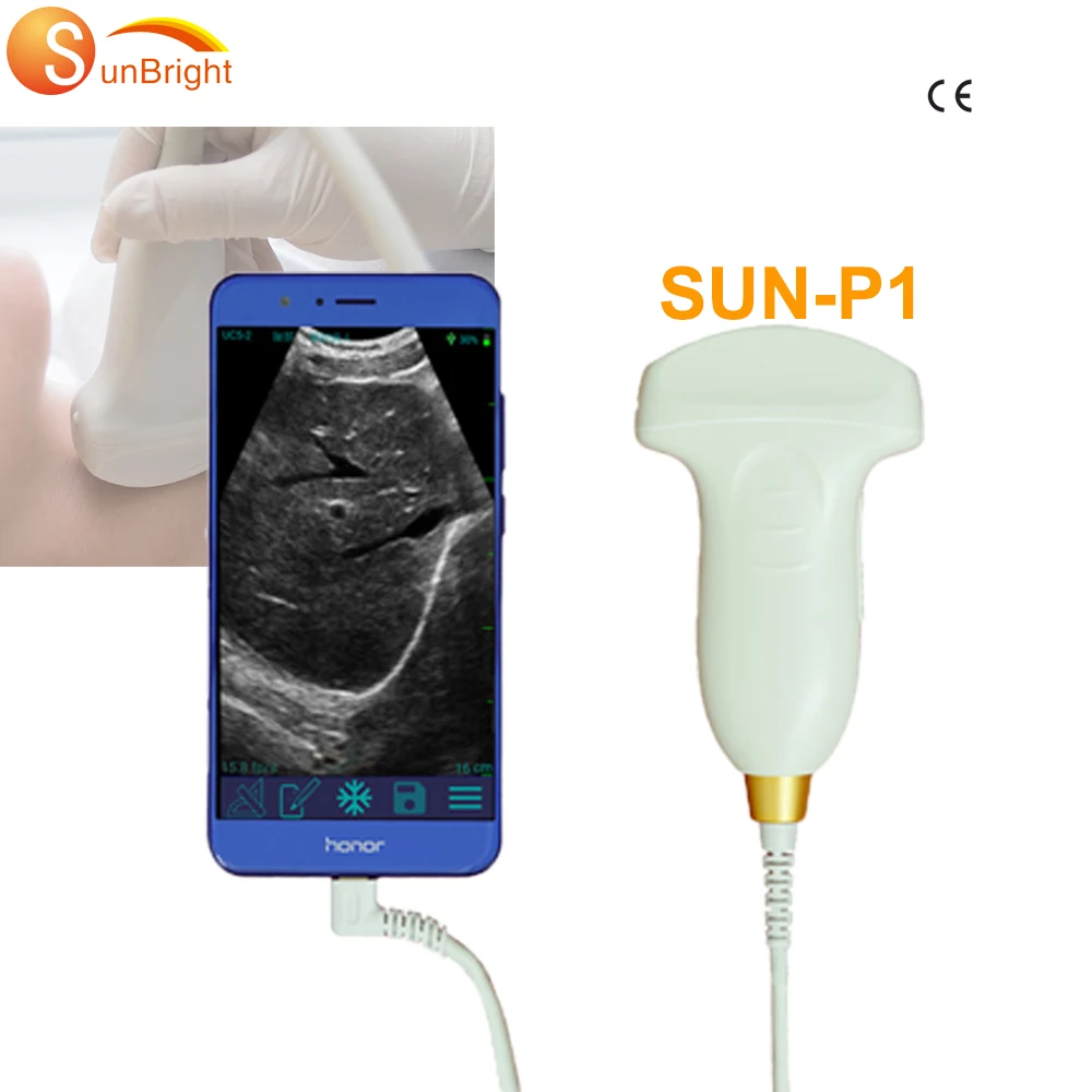 

SUN-P1 USB ultrasound scan convex probe for Android phone tablet