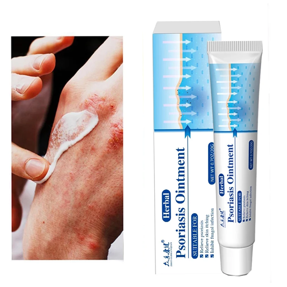 

Antibacterial And Antipruritic CreamPsoriasis CreamHerbal Treatment For EczemaRelief Rash Urticaria Scaling CreamBody Skin Care