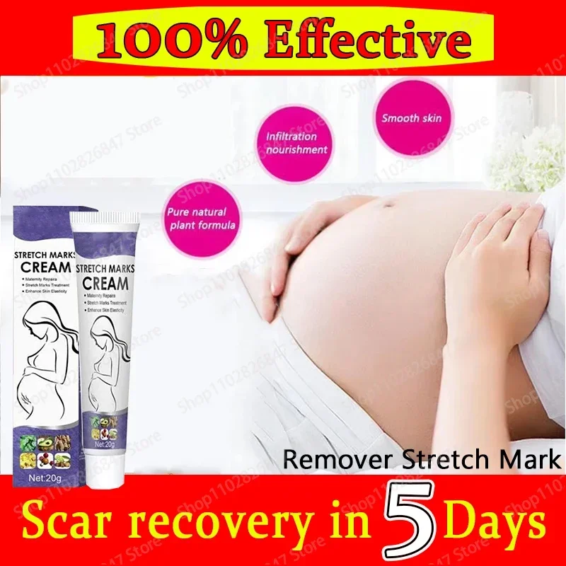 Крем для перманентного удаления растяжек против морщин крем тела беременных