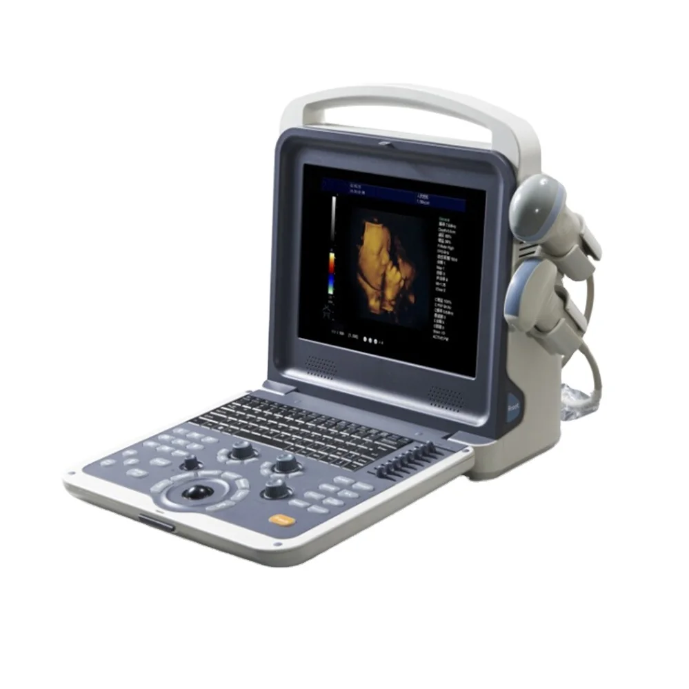 

MY-A035A All Digital Portable pregnancy Color Doppler ultrasound