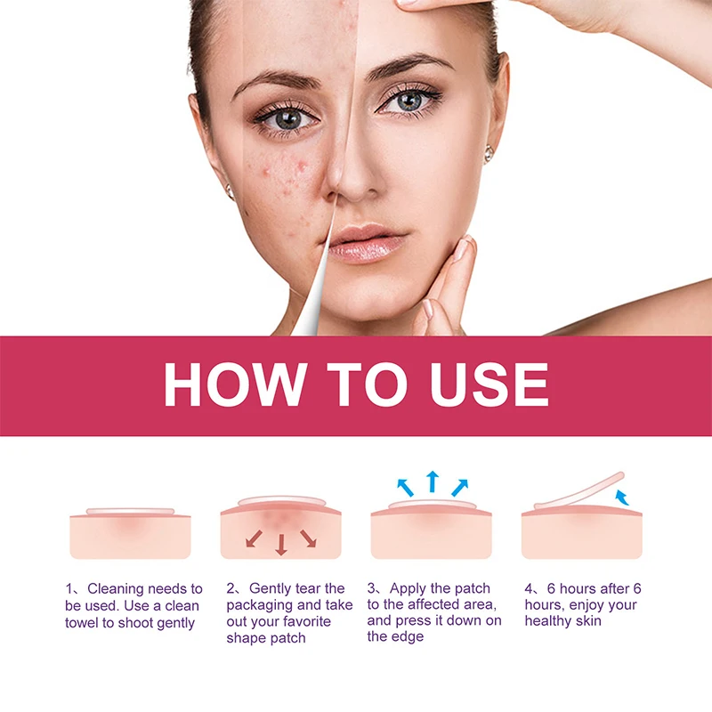 144 шт./коробка цветные наклейки для удаления акне