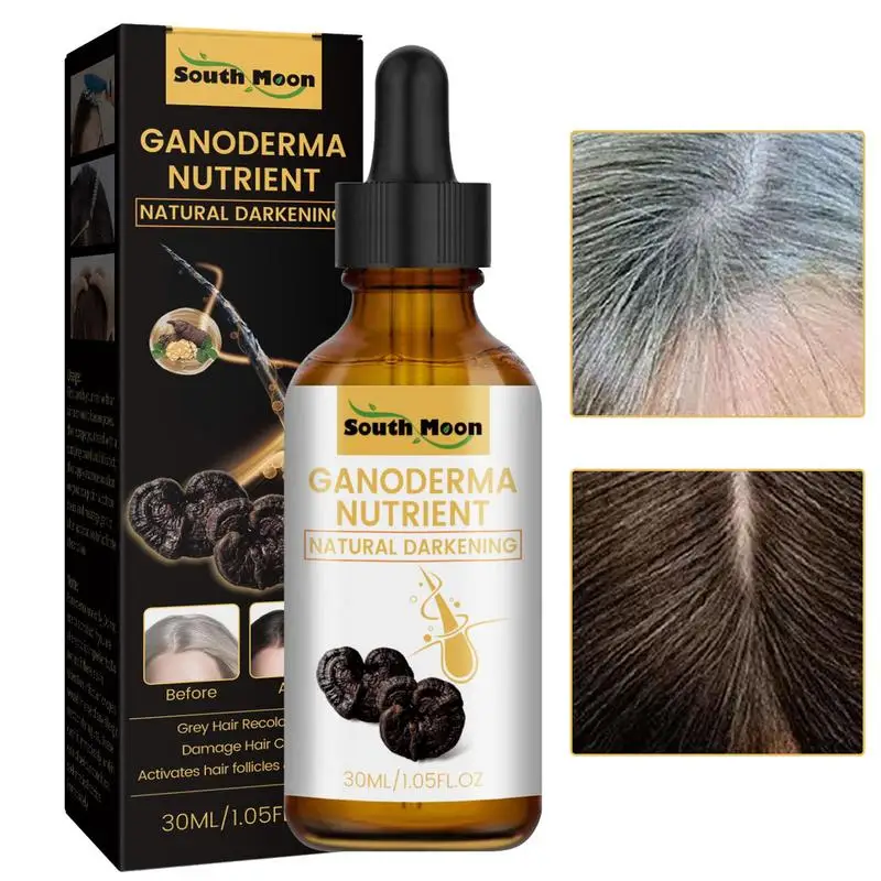 

Sdotter Anti Grey Hair Essence Oil 30ml Hair Rapid Growth Repair Damage Hair Roots Tonic Men Women Regeneration Liquid