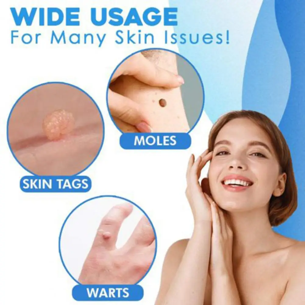 

1 Set Practical Skin Tag Remover Portable to Carry Tag Removing Tool Reusable Ergonomics Swab Cleansing Kit Easy to Use
