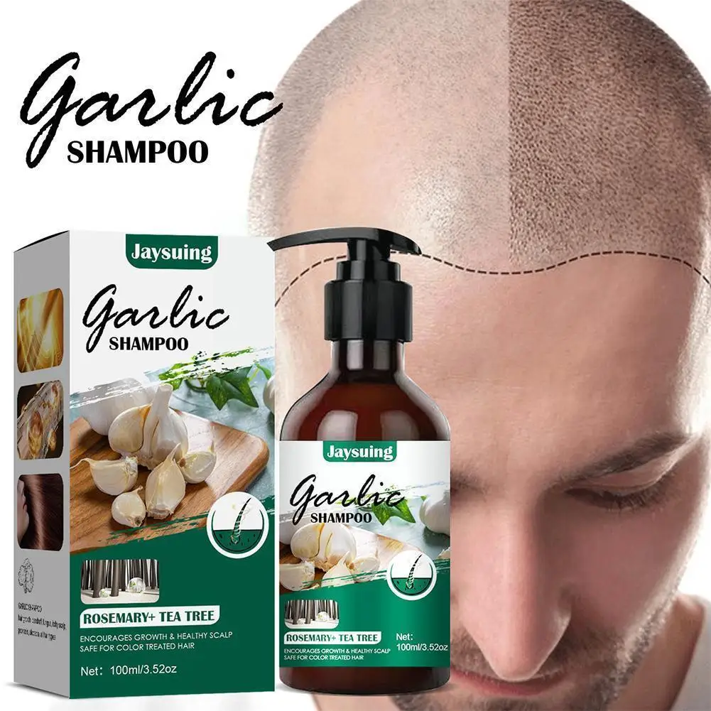 

100ML Hair Growth Shampoo Fast Hair Growth Liquid Treatment Follicle Garlic Care Extract Hair Hair Anti Hair Scalp Loss F9T3