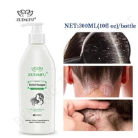 zudaifu hair psoriasis seborrheic skin care treatment dermatitis eczema compound herbal shampoo repair scalp remove dandruff