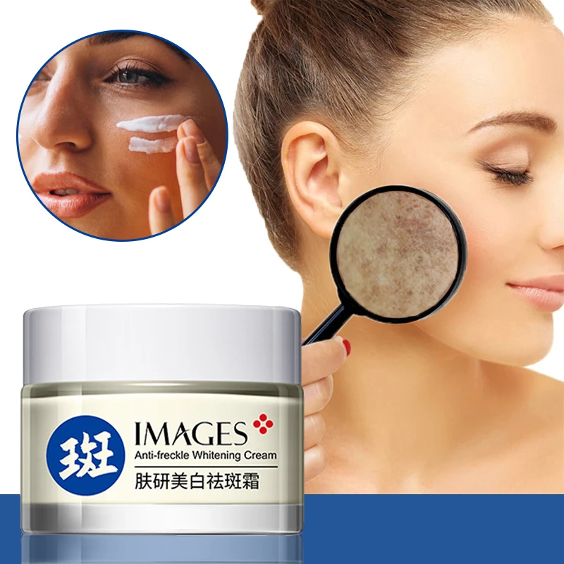 

Face Skin Care Whitening Freckle Cream Remove Chloasma Age Spots Sunburn Pigment Remover Moisturizing Brightening Anti Aging 50g