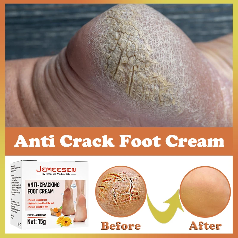 Herbal Anti-cracking Foot Cream Anti-dry Cracked Heel Crack Repair Calluses Dead Skin Moisturizing  Hand  Foot Care 15G