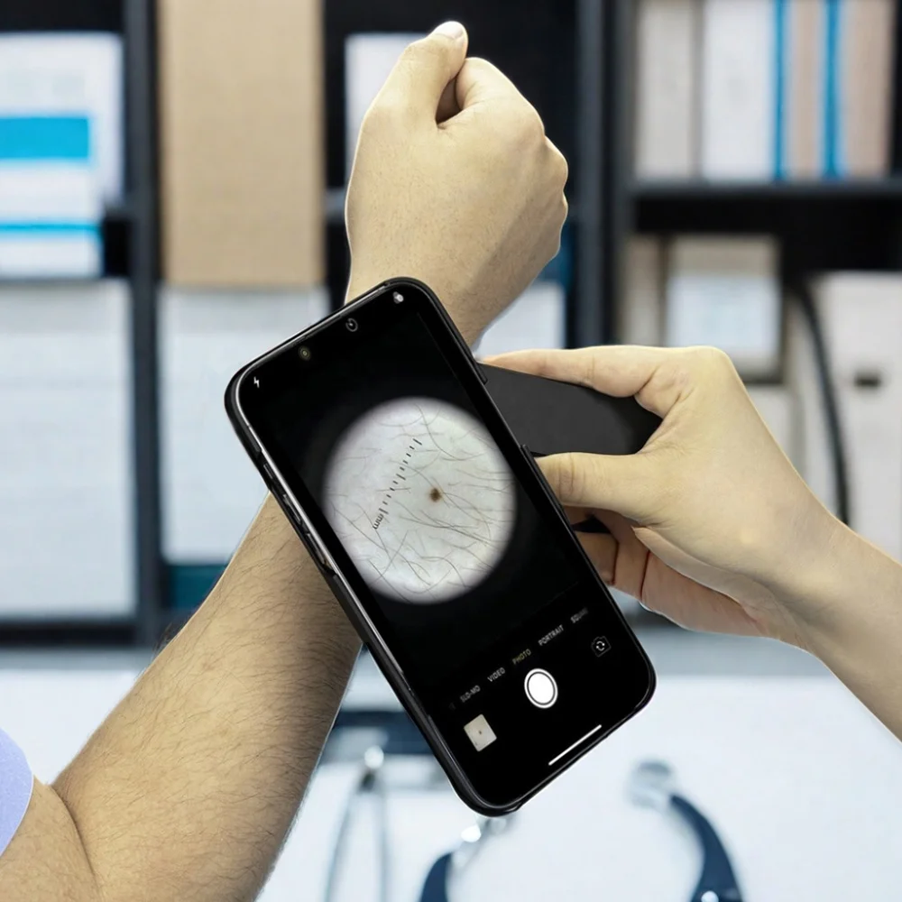 IBOOLO Изысканное оптическое устройство для дермоскопии DE-4100 совместимое со