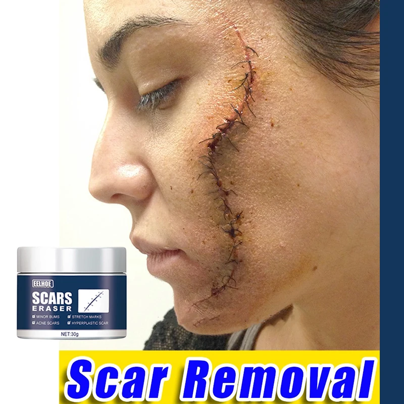 

Scar Removal Cream Repair Caesarean Section Scars Stretch Marks Keloid Severe Scald Treatment Gel Whitening Beauty Health Care