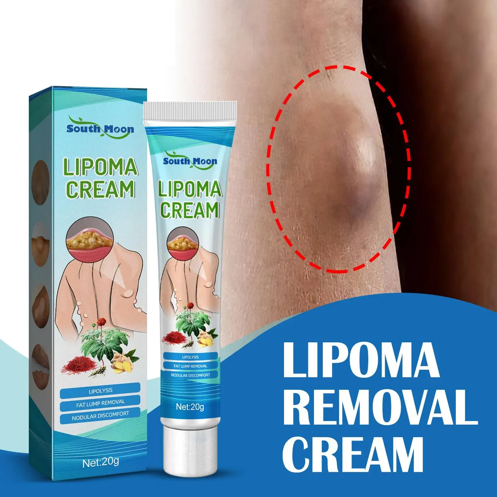 

1pcs Lipoma Treatment Cream Lipolysis Removal Skin Swelling Cellulite Ointment Tumor Exfoliating Pain Relief Plaster
