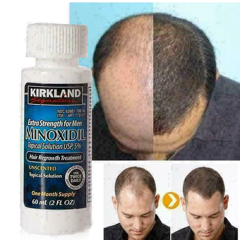 

Kirkland Signature 5% Extra Strength Hair Regrowth Treatment For Men - Solution 60ml 2 FL.OZ