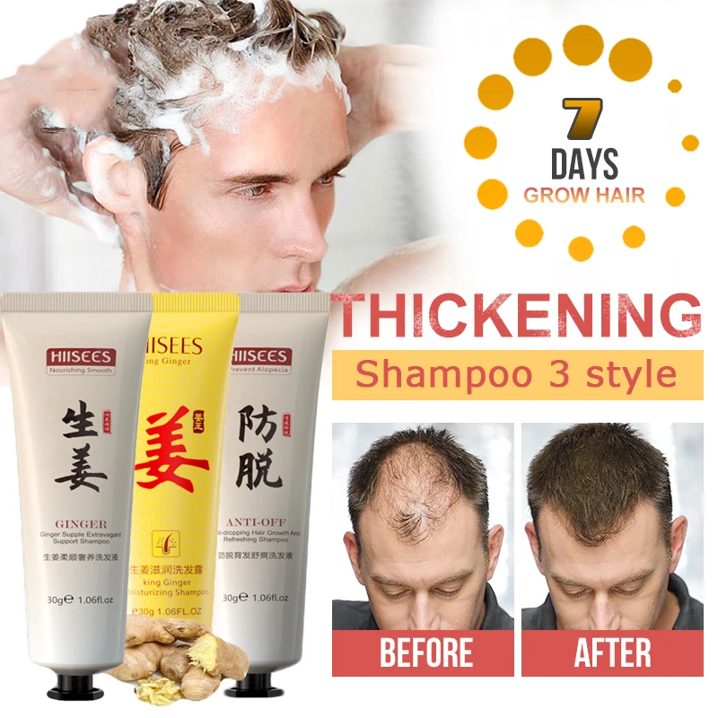 

Hair Growth Shampoo Hair Loss Shampoo Helps Stop Hair Loss Grow Hair Fast Scalp Follicle Treatment for Men Women Beauty Products