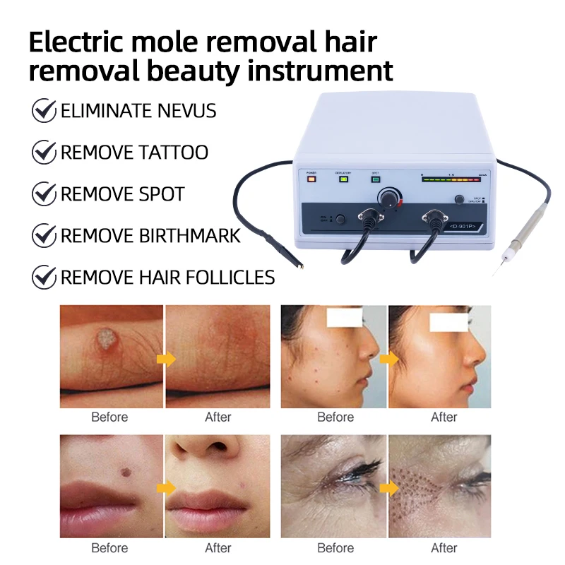 Профессиональный портативный салонный аппарат для удаления волос бородавок