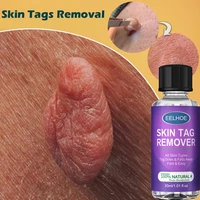 skin tag remover serum painless mole skin dark spot remover essential oil freckle wart tag acne dark spot remover skin care30ml