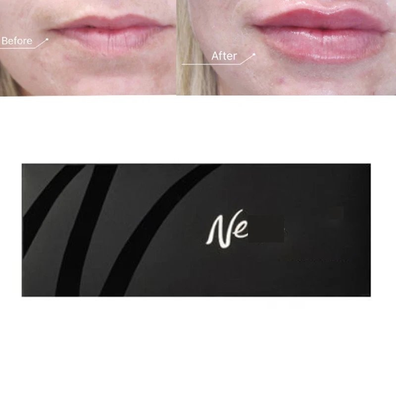 

1 шт., гиалуроновая кислота для губ, 1 мл