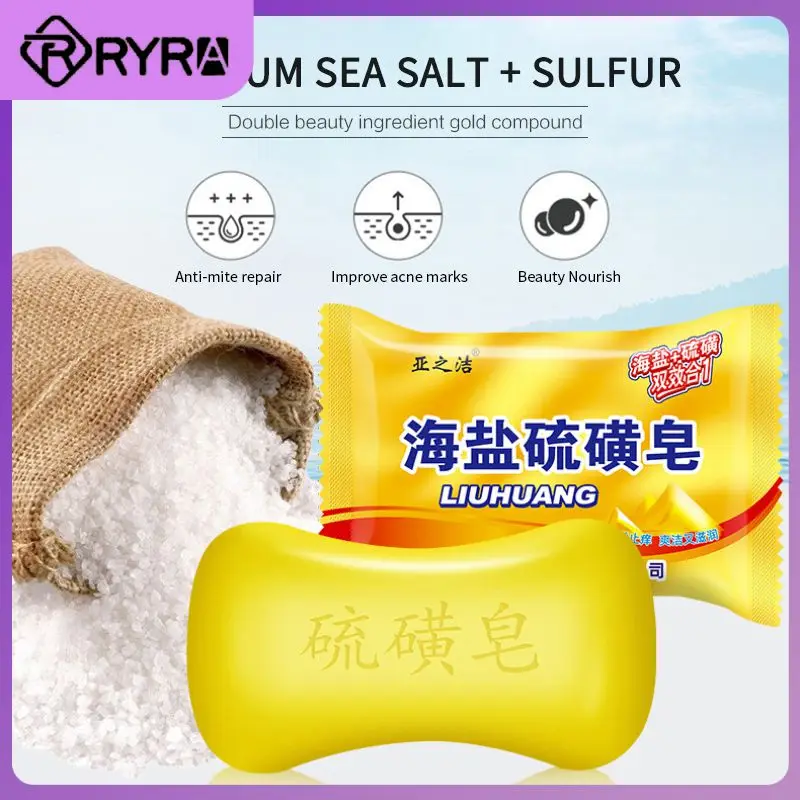 

Shanghai Sulfur Soap Oil-Control Acne Treatment Psoriasis Seborrhea Eczema Anti Fungus Bath Healthy Soaps For Bath