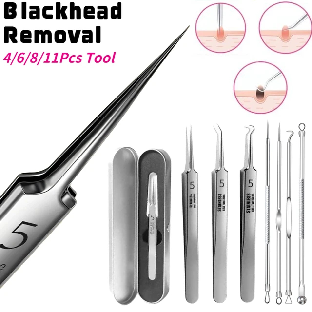 Professional Ultra-fine No. 5 Acne Blackhead Removal Tweezers Beauty Salon Pimples Needles Deep Cleaner Clip Face Skin Care Tool 1