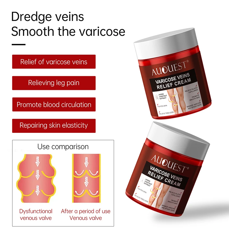 

AUQUEST Varicose Veins Treatment Cream Relieve Tired Legs Dilated Vasculitis Phlebitis Spider Pain Relief Ointment Body Care 80g