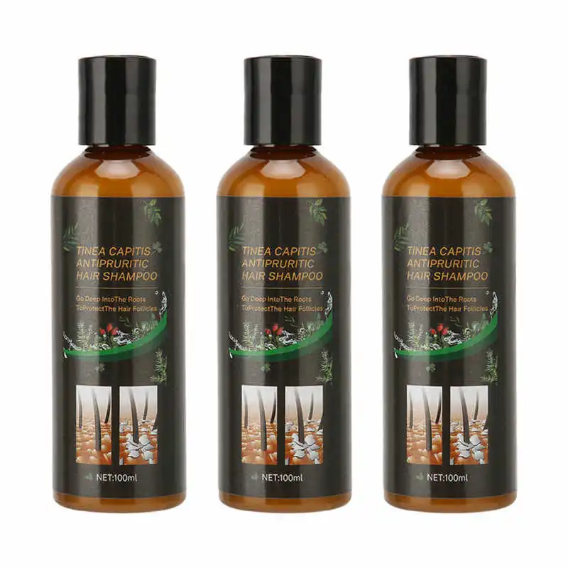 

Oil Control Shampoo Dandruff Removal Shampoo Nourishing for Hair Care