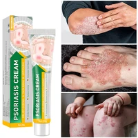 5pcs antibacterial cream psoriasis femoris sensitive skin inflammation rednes itching treat lotion fast itching moisturizing gel