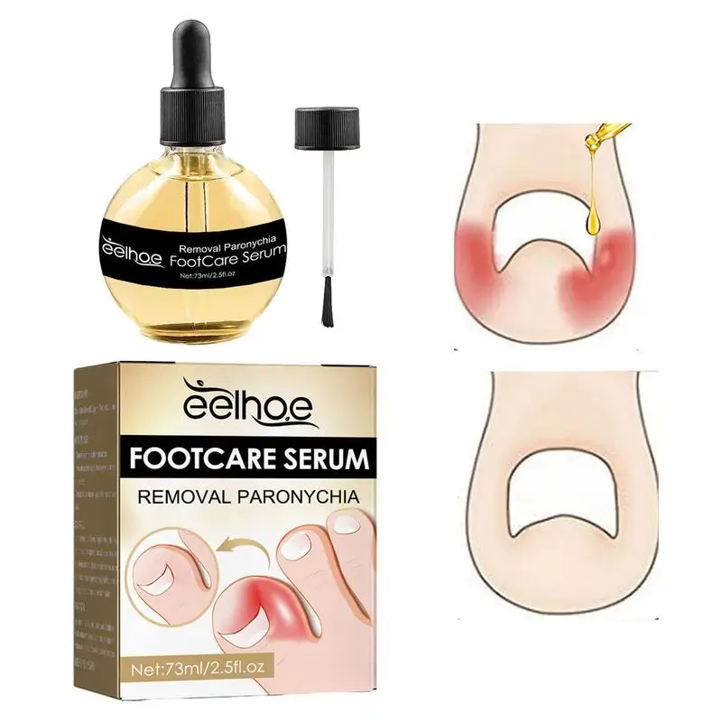 

Anti Paronychia Relief Oil Nail Repair Improve Toenail Health Anti-Inflammatory Foot Care Serums Suitable For Men And Women
