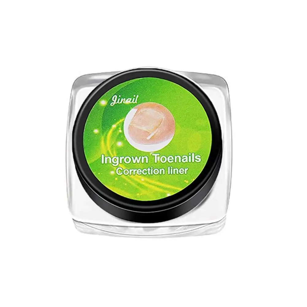 

10/20/30/50 шт., вросшие гвозди