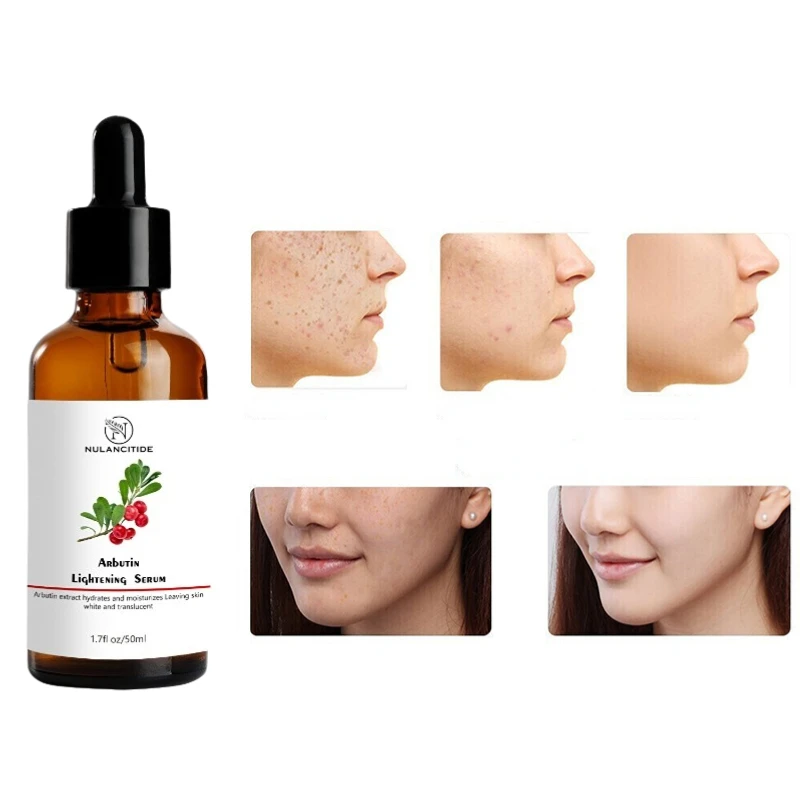 

Arbutin Skin Brightening Whitening Essence Liquid For Removing Chloasma Lightening Brightening Serum Kojic Acid Bleaching Serum