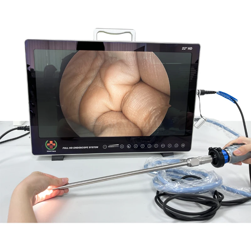 

SY-PS050 medical 80W LED cold light source full hd endoscope camera system on promotion