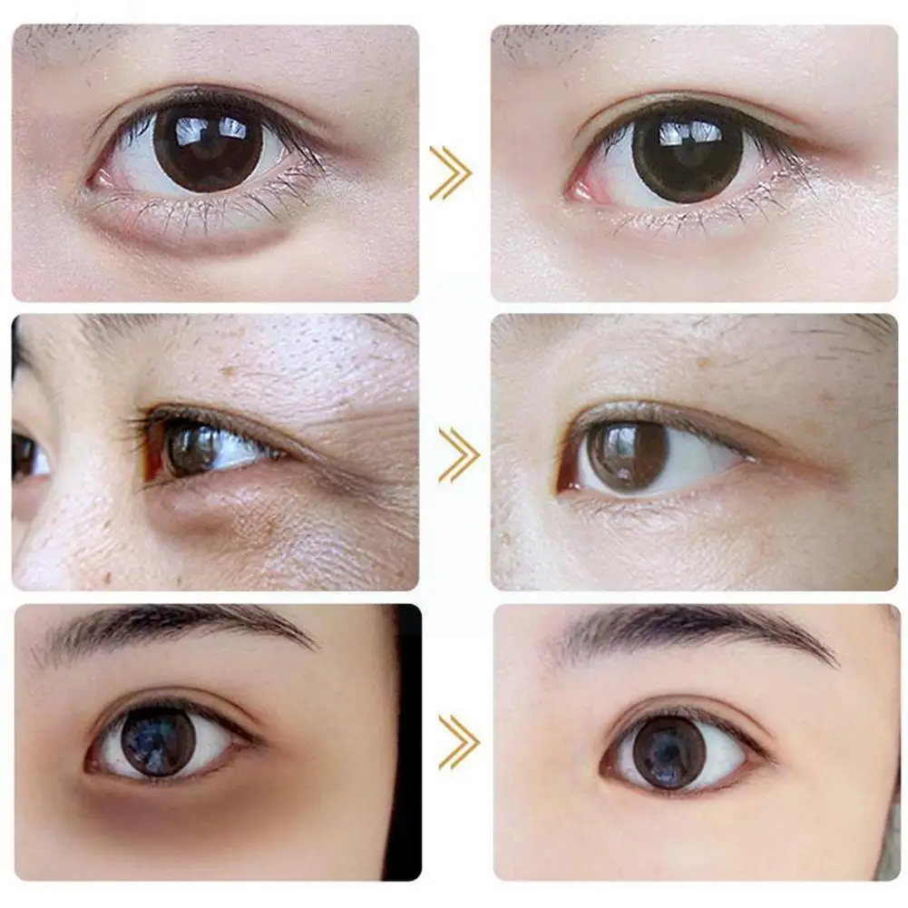 

30g Retinol Eye Cream Remove Eye Bags Cream Anti Puffiness Wrinkles Care Aging Circles Delays Dark Fades Firming Skin Gel W1e8