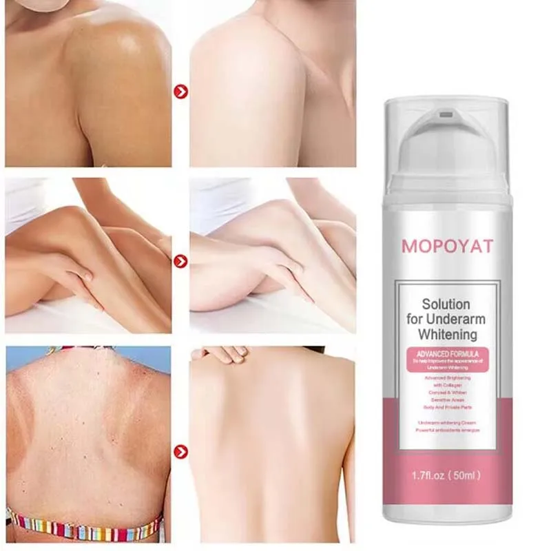 

Nicotinamide Body Whitening Cream Underarm Intimate Area Bleach Brighten Lotion Hyaluronic Acid Moisturizing Beauty Care Product