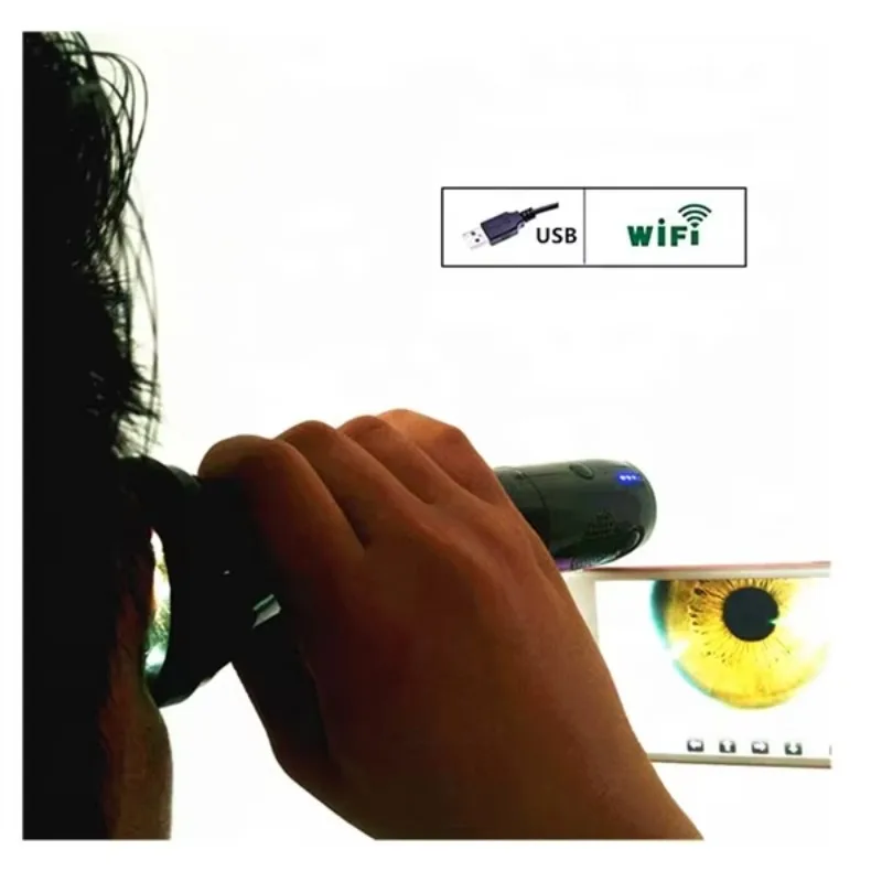 Фото Горячая распродажа: Цифровой Wi-Fi микроскоп/ирископ ML-401 с желтыми и белыми светодиодами, видео, 100% исправность, быстрая доставка №5