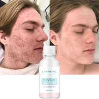 30ml acne removal serum salicylic acid anti acne repair fade acne spots pimple oil control whitening moisturizing skin care