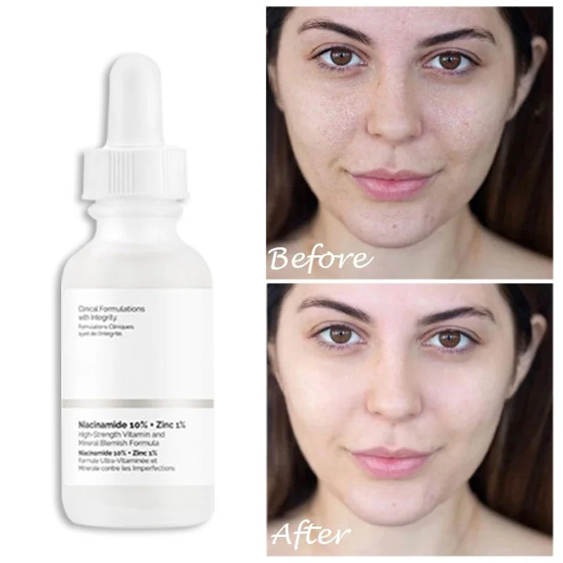 

30ml Whitening Moisturizing Oil Control Essence Brighten Skin Tone Niacinamide Serum Acne-reducing Shrink Pores Facial Serum