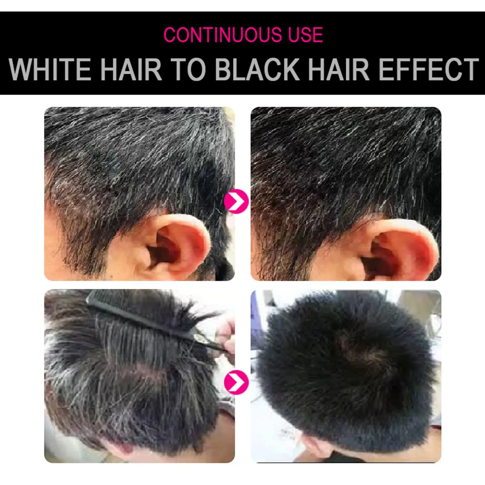 Сыворотка для лечения волос Sevich спрей роста восстанавливающий белый