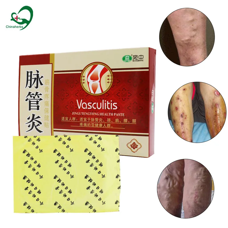 

2 Boxes/12 Pcs Varicose Vein Medical Plaster Spider Vasculitis Phlebitis Rheumatism Angiitis Pain Relief Chinese Herbal Patch