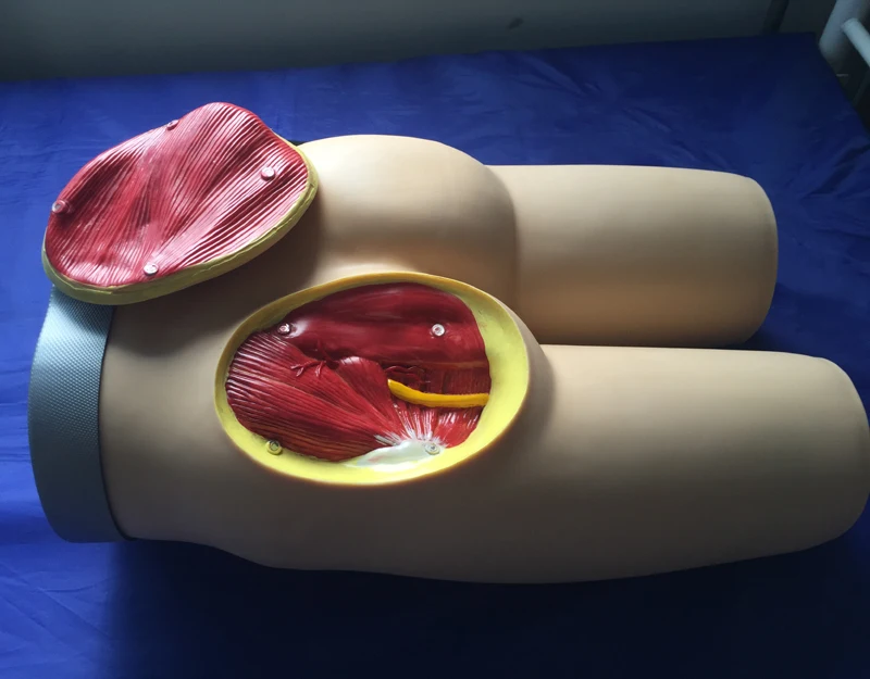 

Advanced Intramuscular Injection of Buttocks and Anatomical Structure Model