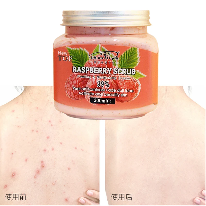 

300g Hot Sale Raspberry Scrub Full Body Exfoliating Improve Chicken Skin Pore Deep Cleansing Scrub mask for face