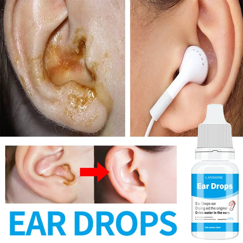 

Ear Ringing Relieving Drops Relieve Deafness Tinnitus Itching Earache Swelling Discharge Treatment Hard Hearing Tinnitu Symptom