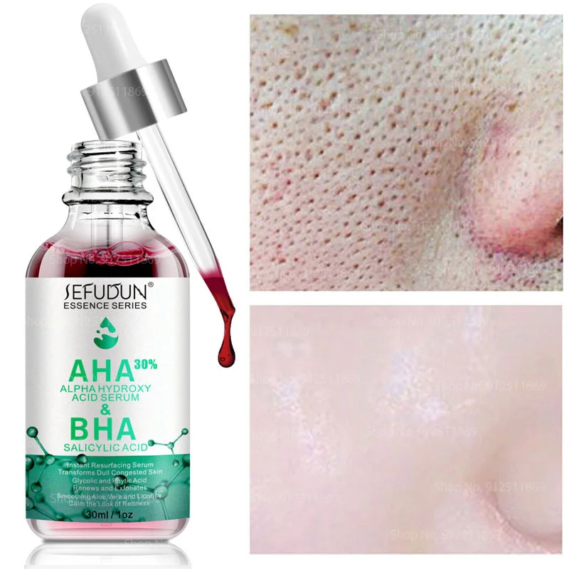 

Сыворотка для сужения пор с салициловой кислотой, фруктовая кислота, отшелушивающий, восстанавливающий, от акне, отбеливающая эссенция, пит...