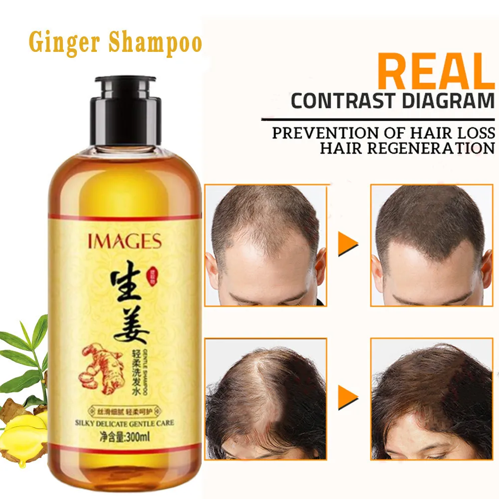 

Genuine Professional Hair Ginger Shampoo 300ml, Hair Regrowth Dense Fast, Thicker, Hair Growth Shampoo Anti Hair Loss Product