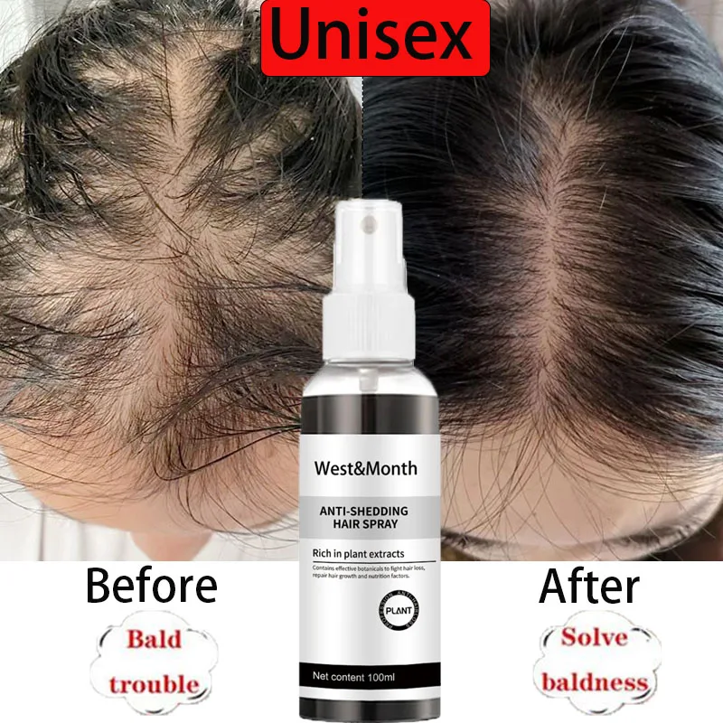 

Hair Growth Spray Anti Hair Loss Products Fast Growing Prevent Baldness Treatment Nourishing Scalp Hair Regrowth Essence 100ML