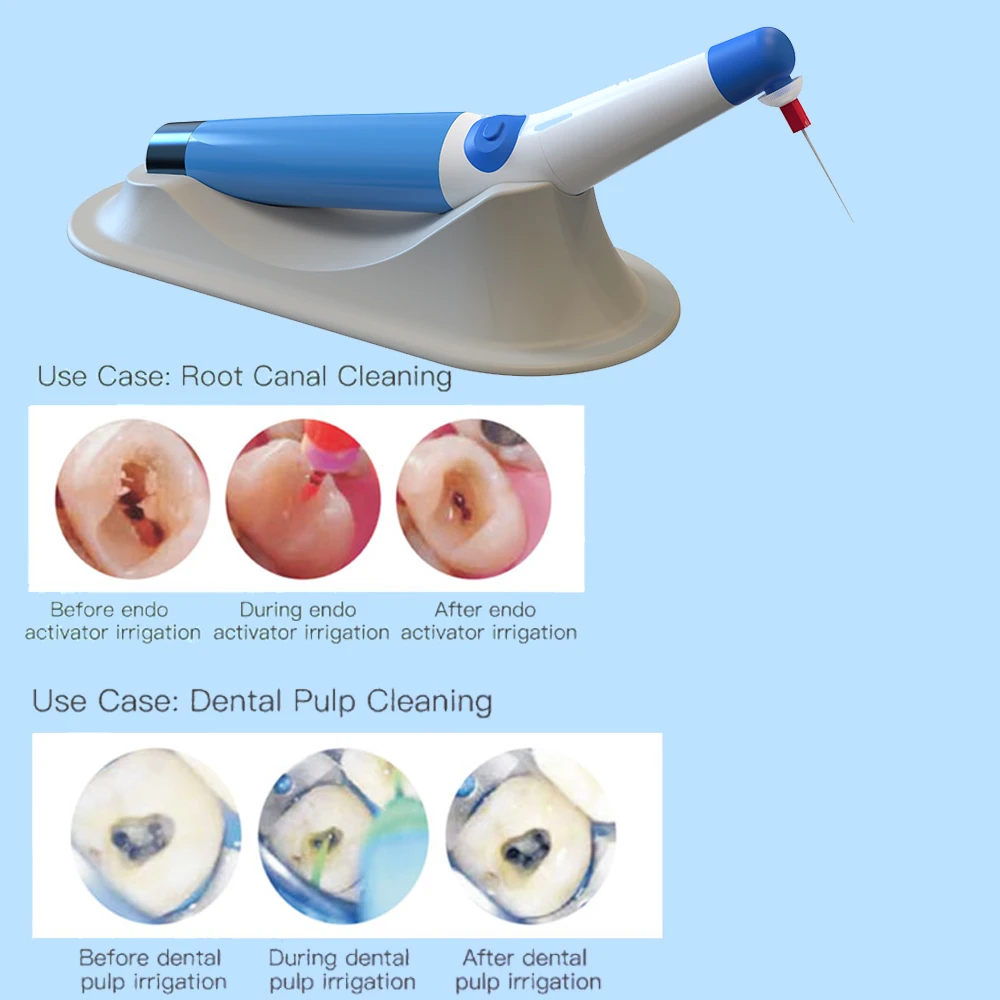 Ирригатор JNSUR Dental Endo Беспроводной ультразвуковой ирригатор с эндомотором