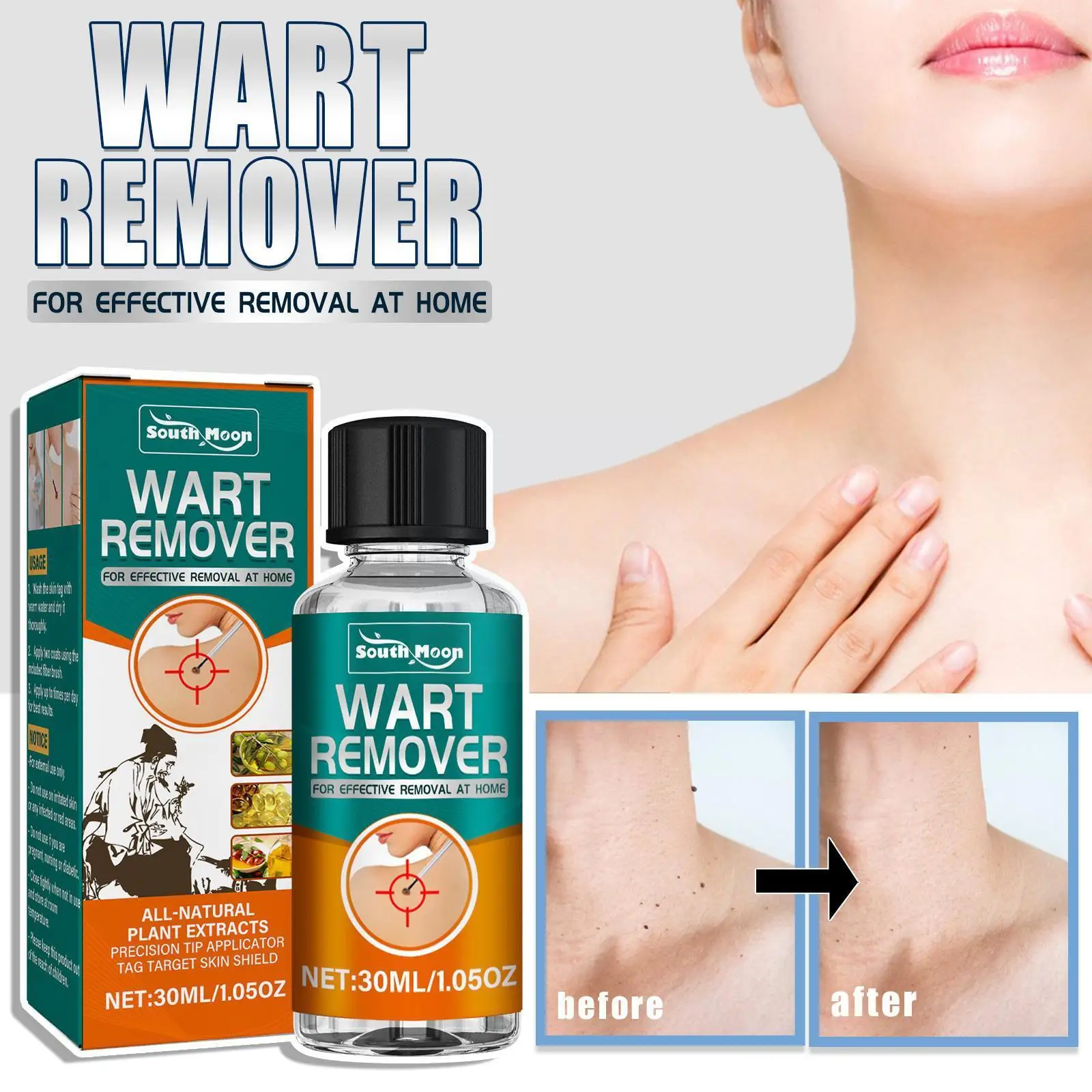 

30ml Wart Tag Treatment Removal Essential Oil Skin Spot Wart Serum Skin Warts Mole Remover Remover Dark Remover Painless Ta P2Q2