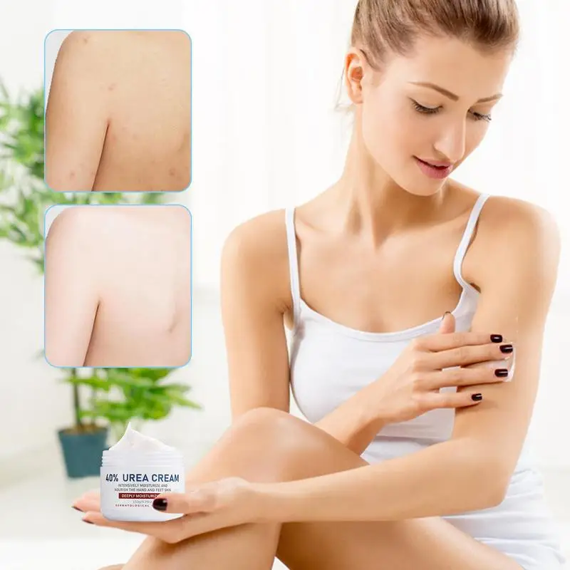 

Urea Hand Cream Hand Moisturizer For Women 40 Percent Urea Cream Hydrating Cream For Dry Cracked Hands Elbows Feet Heels Knees