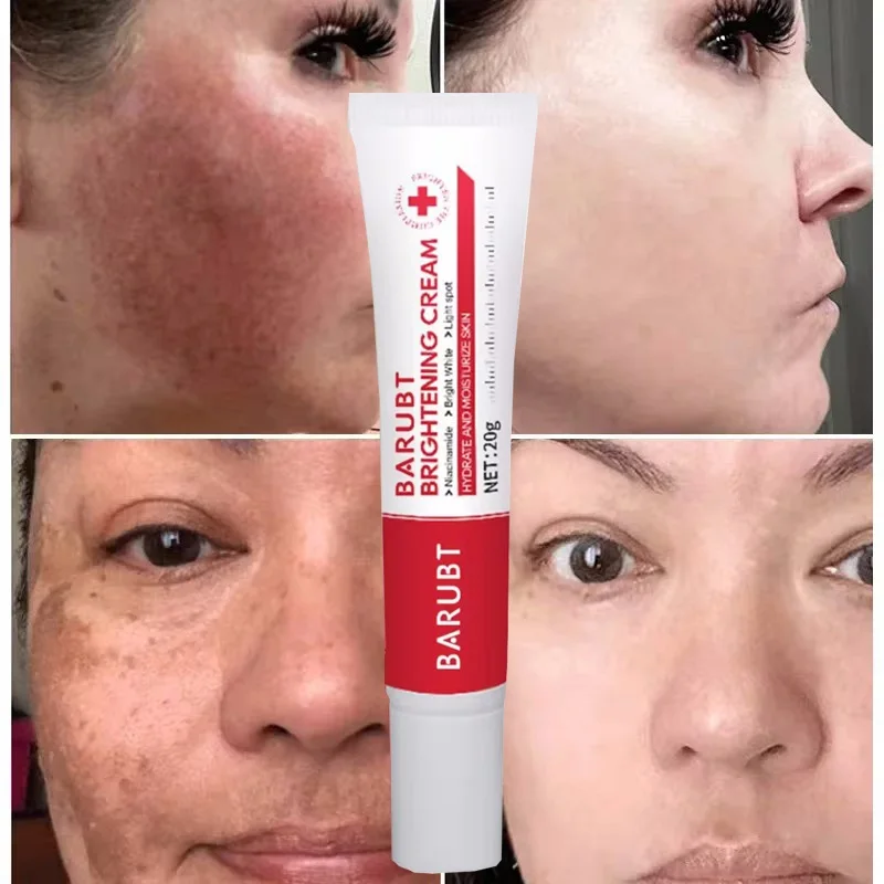 Мощный отбеливающий крем для удаления пятен быстро удаляет кожу меланин