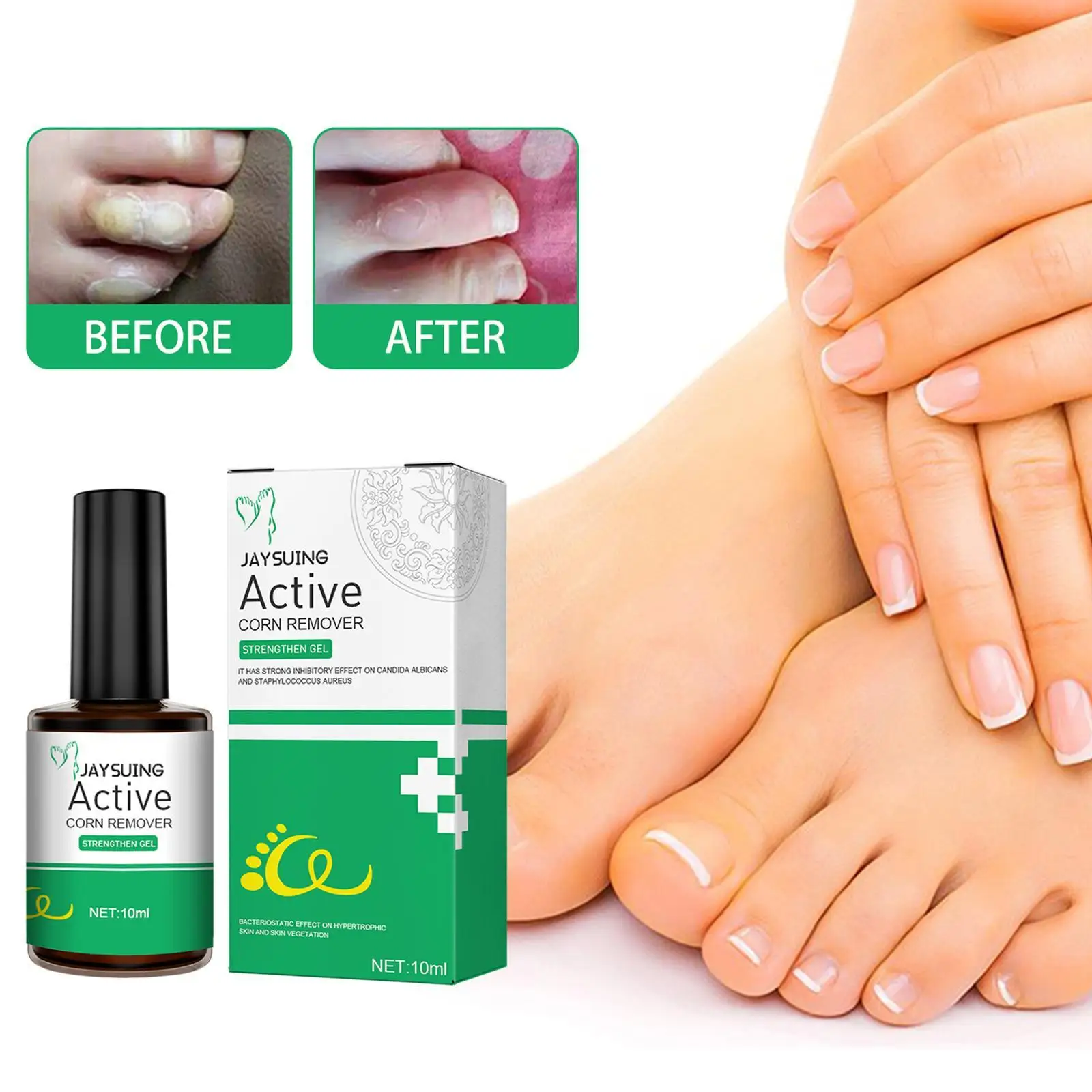 

10ml Wart Remover For Feet Skin Tags Remover Against Moles Meat Thorn Flat Wart Foot Corn Wart Removal Liquid Skin Care