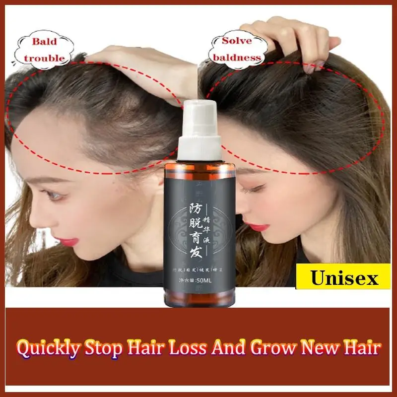 

Herbal Essence Fast-promoting Hair Growth Serum Improve Hair Follicle Nourishing Hair Root Fall Treatment Spray