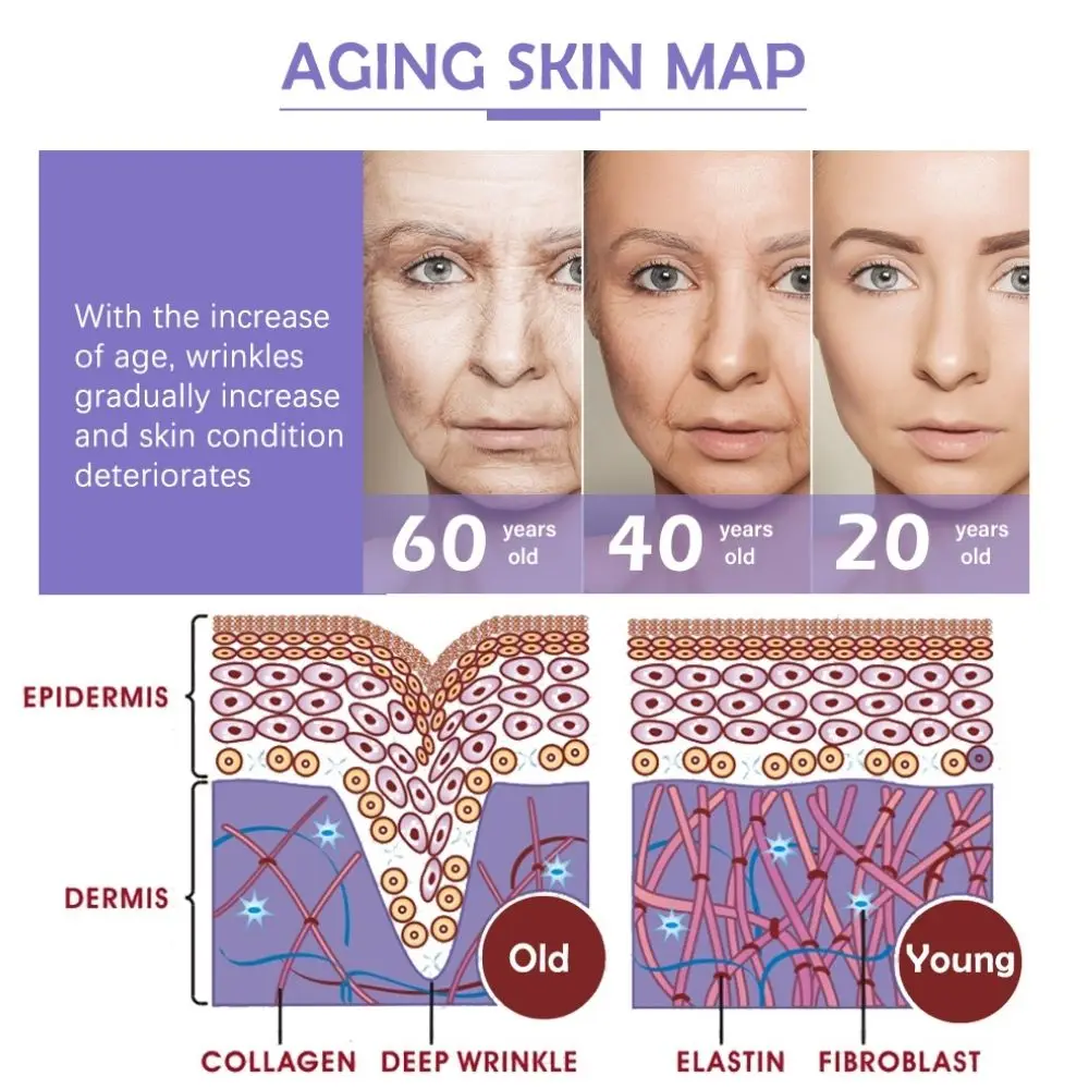 Рисунок 5 - шприцевые иглы для мезотерапии