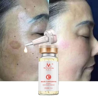 vitamin c whitening serum brighten dark spots freckles anti aging anti wrinkle moisturizing acne scars face essence vc skin care